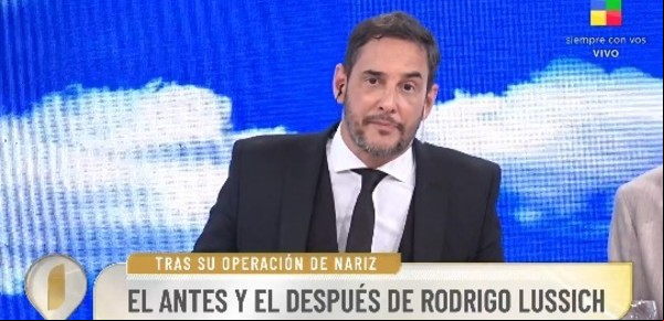 Rodrigo Lussich se sometió a una operación estética y mostró el resultado: el antes y el después