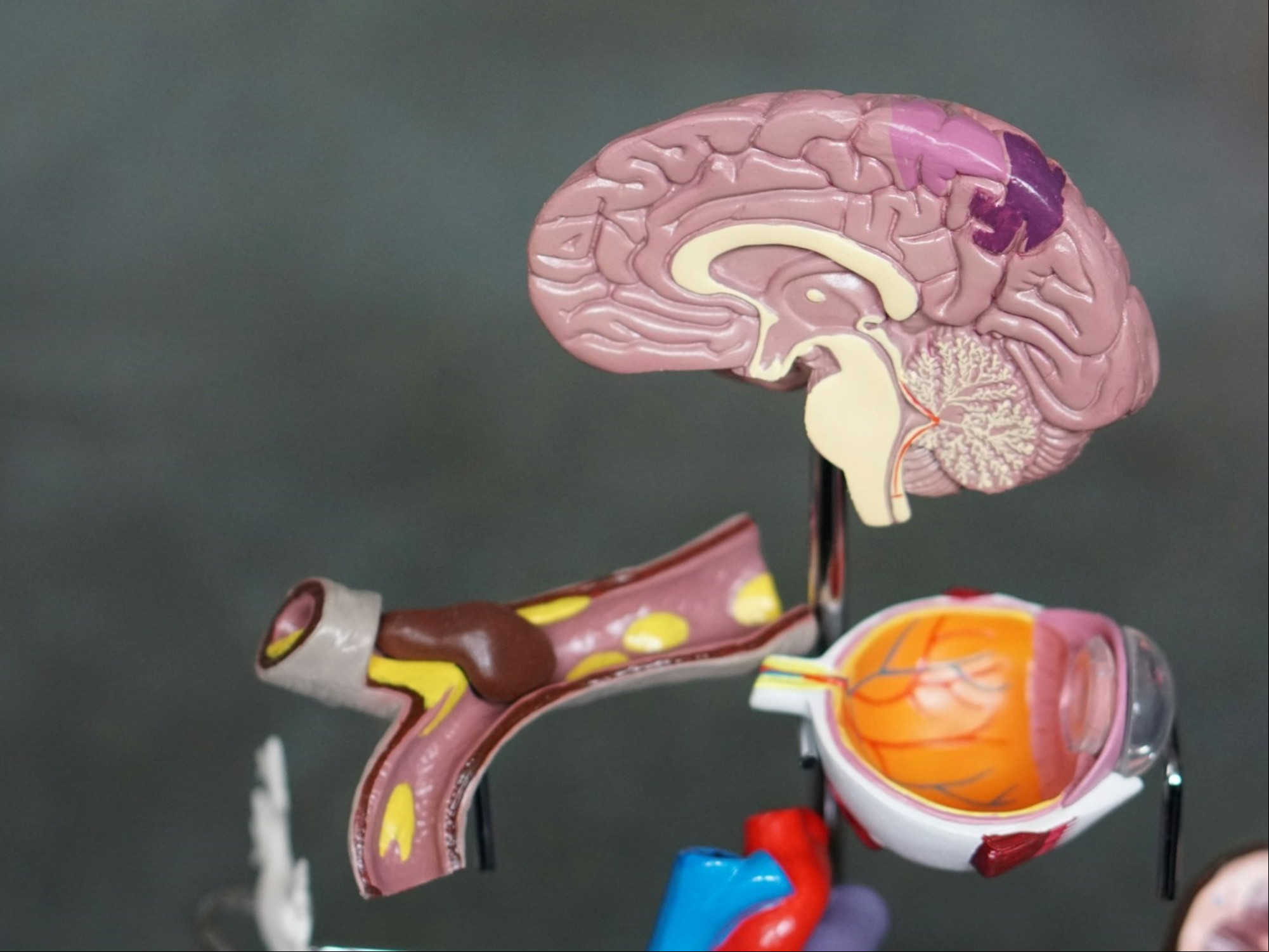 Qué ayuda a mejorar la salud del cerebro. Foto: UnsPlash