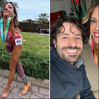 Nadia, la mujer que nació sin extremidades y hoy motiva a miles en las redes sociales