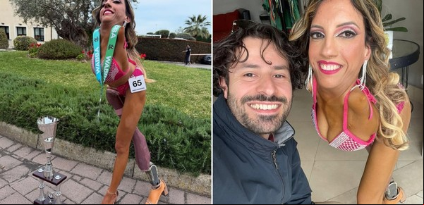 Nadia, la mujer que nació sin extremidades y hoy motiva a miles en las redes sociales