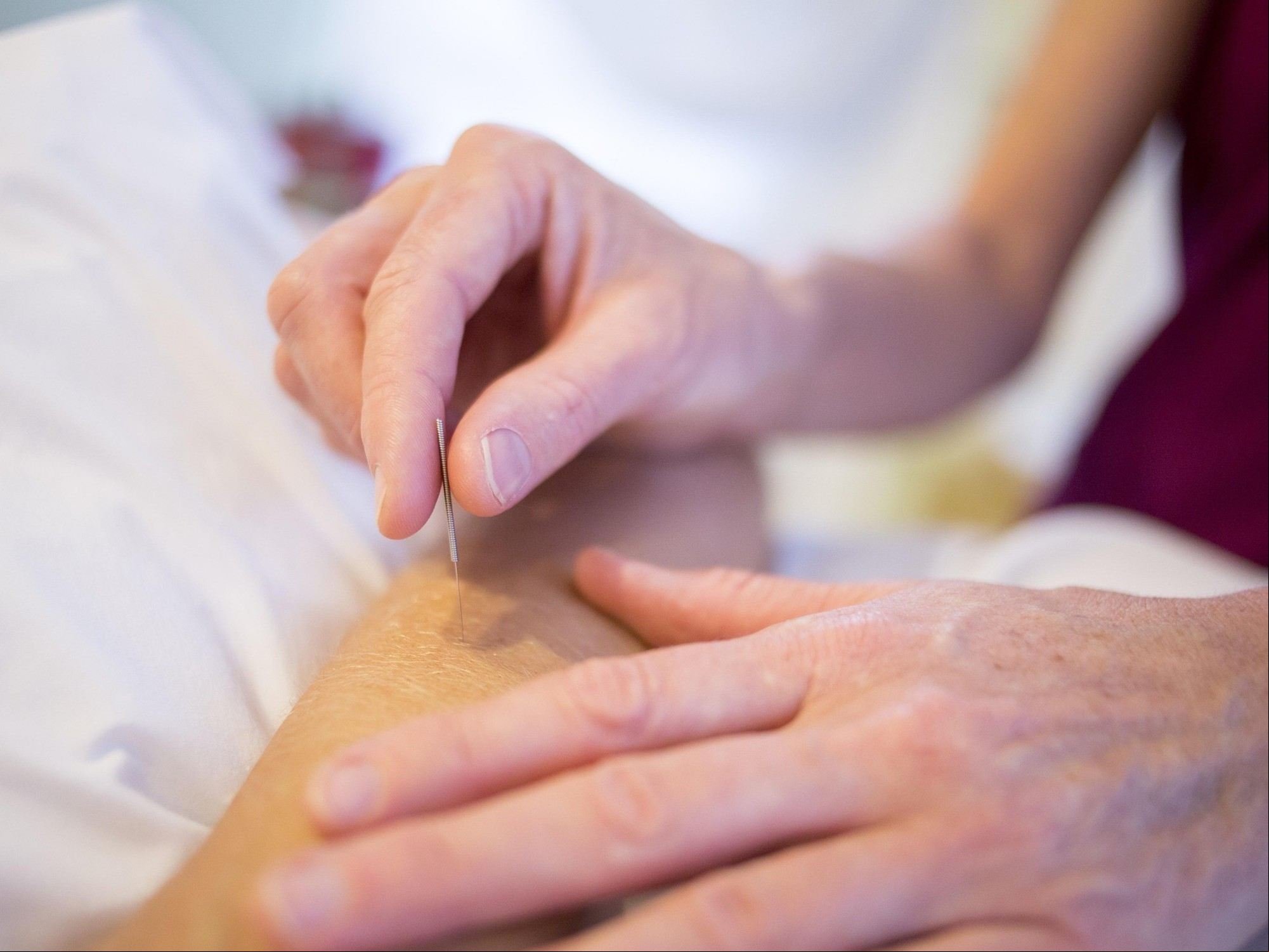 Qué es la acupuntura y puntos de presión corporal. Foto: Pixabay